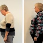 A before-and-after comparison showcasing improved posture after treatment by the best chiropractor in Birmingham.