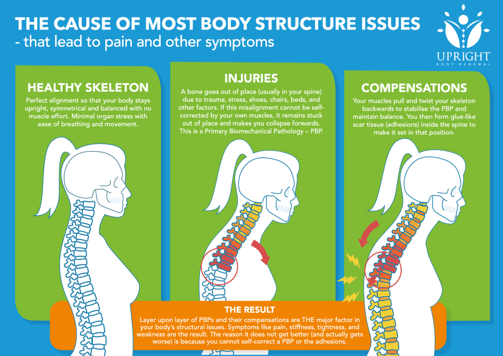 An illustrated breakdown of skeletal misalignments and the benefits of seeing the best chiropractor in Birmingham.