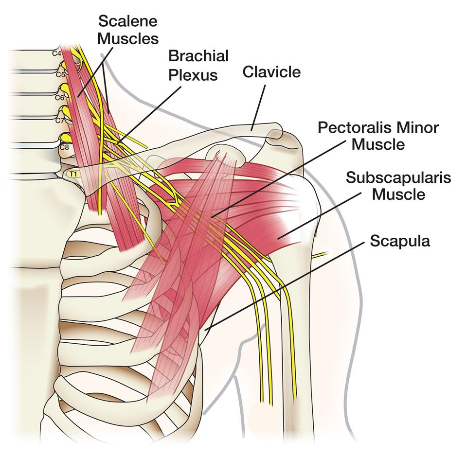 Nerve illustration and how it  cause carpal tunnel problems