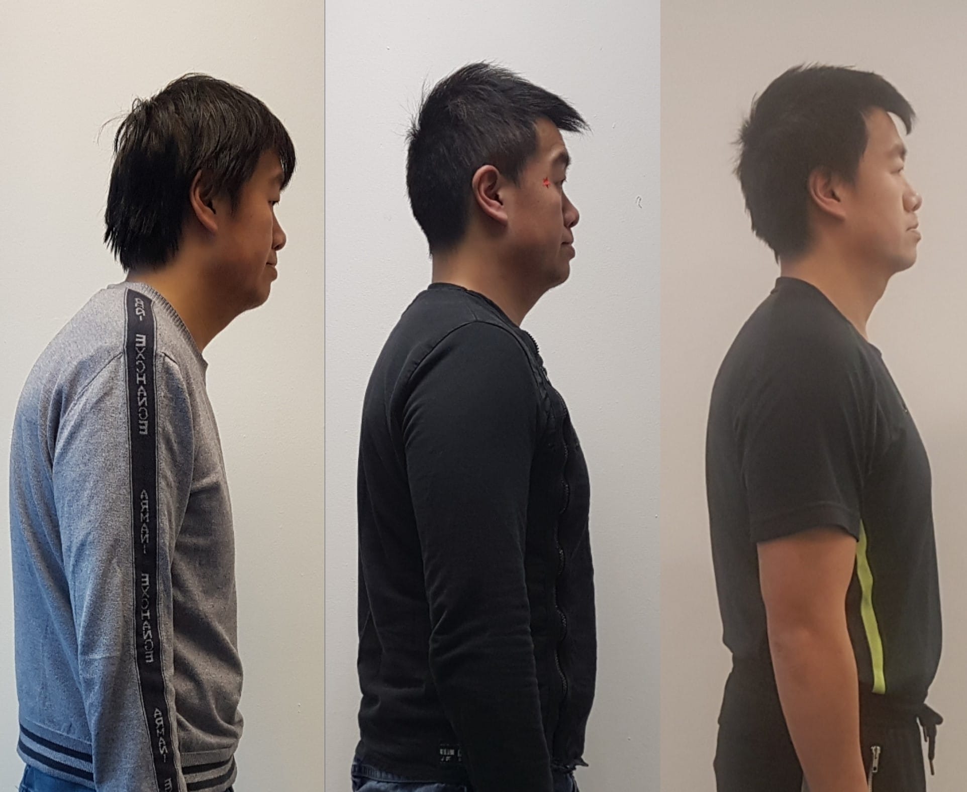 Raymond-Before-and-After