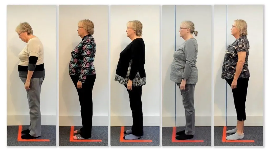 A sequence showing a patient’s posture correction after chiropractic treatments, demonstrating the benefits of visiting a chiropractor near me.
